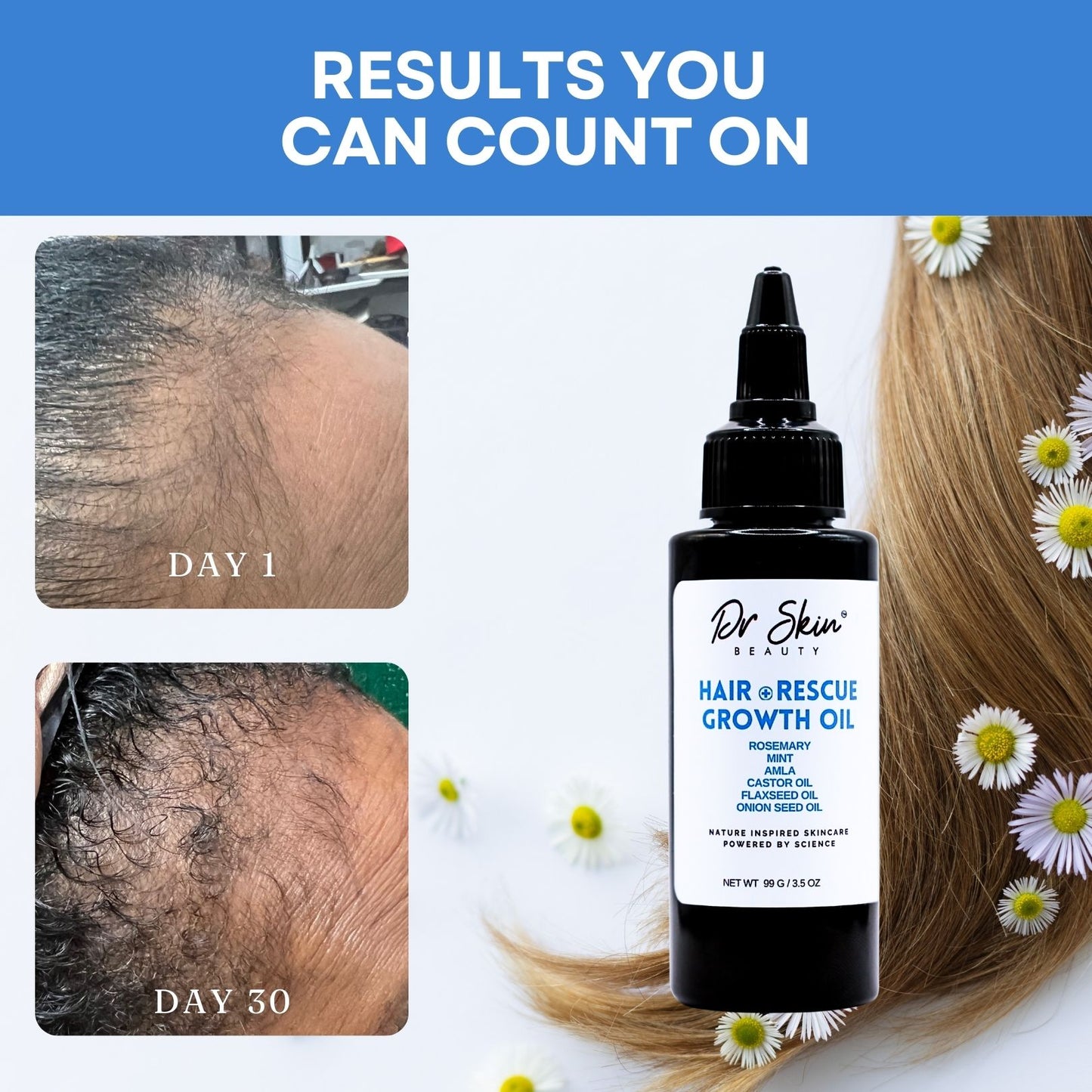 HAIR RESCUE | Growth Oil